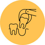 Wisdom Tooth Extraction