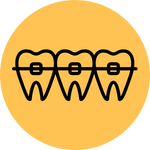 Teeth Braces